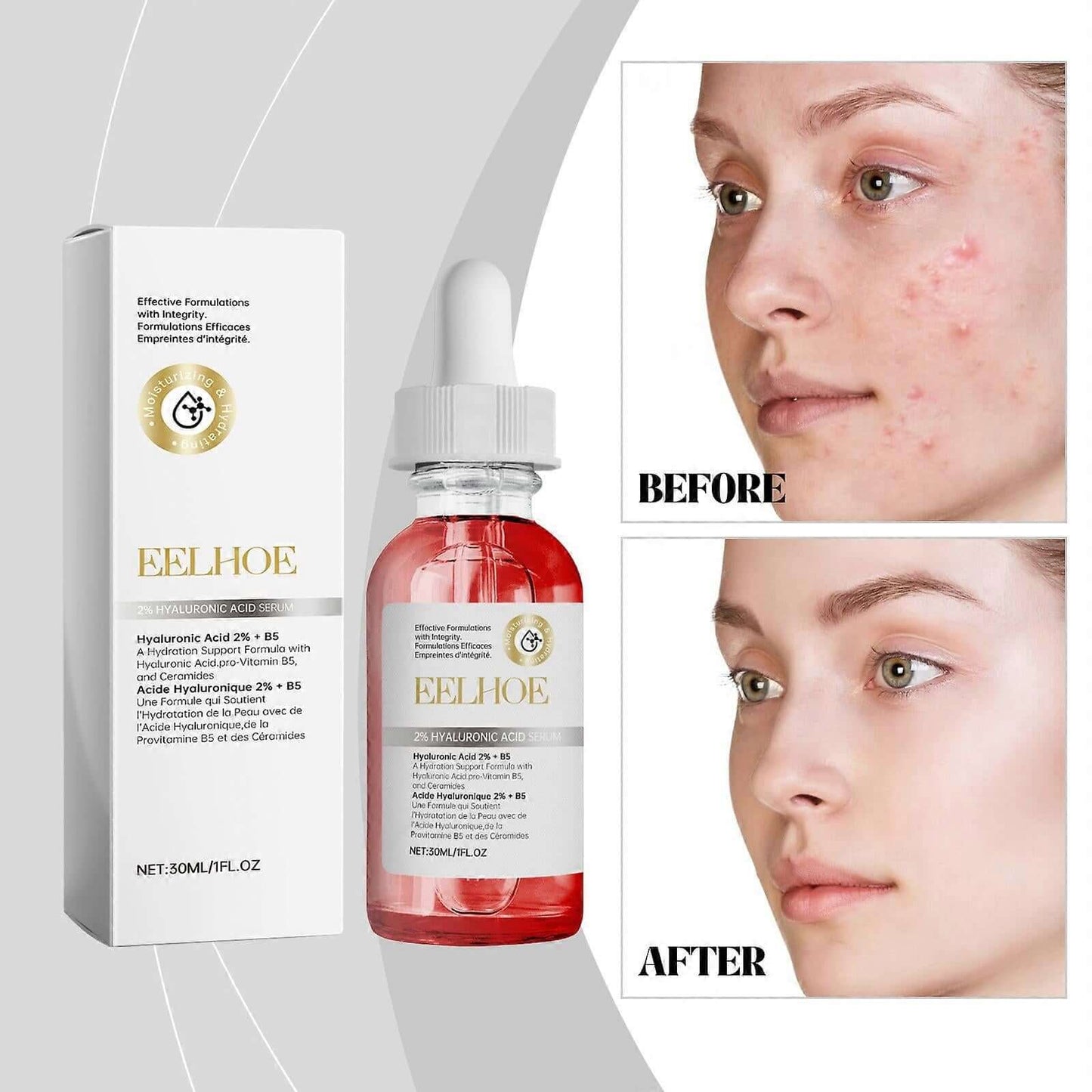 Sérum à l’Acide Hyaluronique – Hydratation Intense et Effet Repulpant pour une Peau Lisse et Éclatante