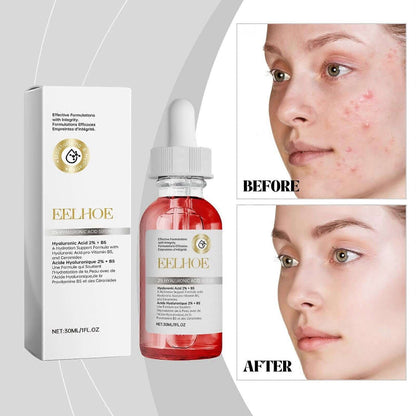 Sérum à l’Acide Hyaluronique – Hydratation Intense et Effet Repulpant pour une Peau Lisse et Éclatante