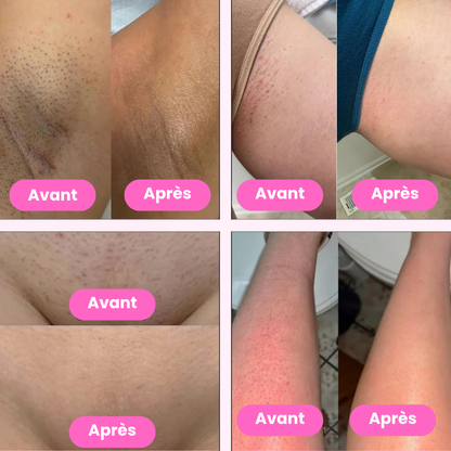 Lady Shaver – Épilateur Électrique pour une Peau Douce et Lisse