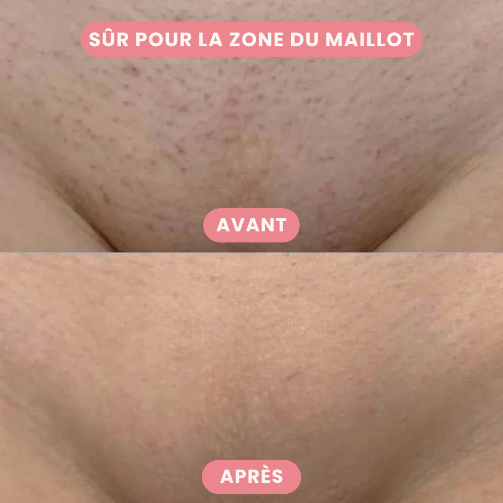Tondeuse 2-en-1 pour le Maillot et le Visage – Épilation Précise et Douce