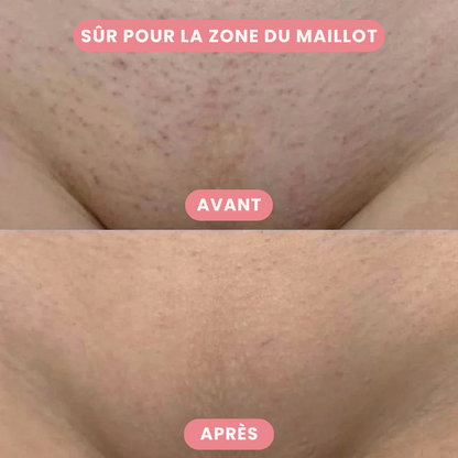 Tondeuse 2-en-1 pour le Maillot et le Visage – Épilation Précise et Douce