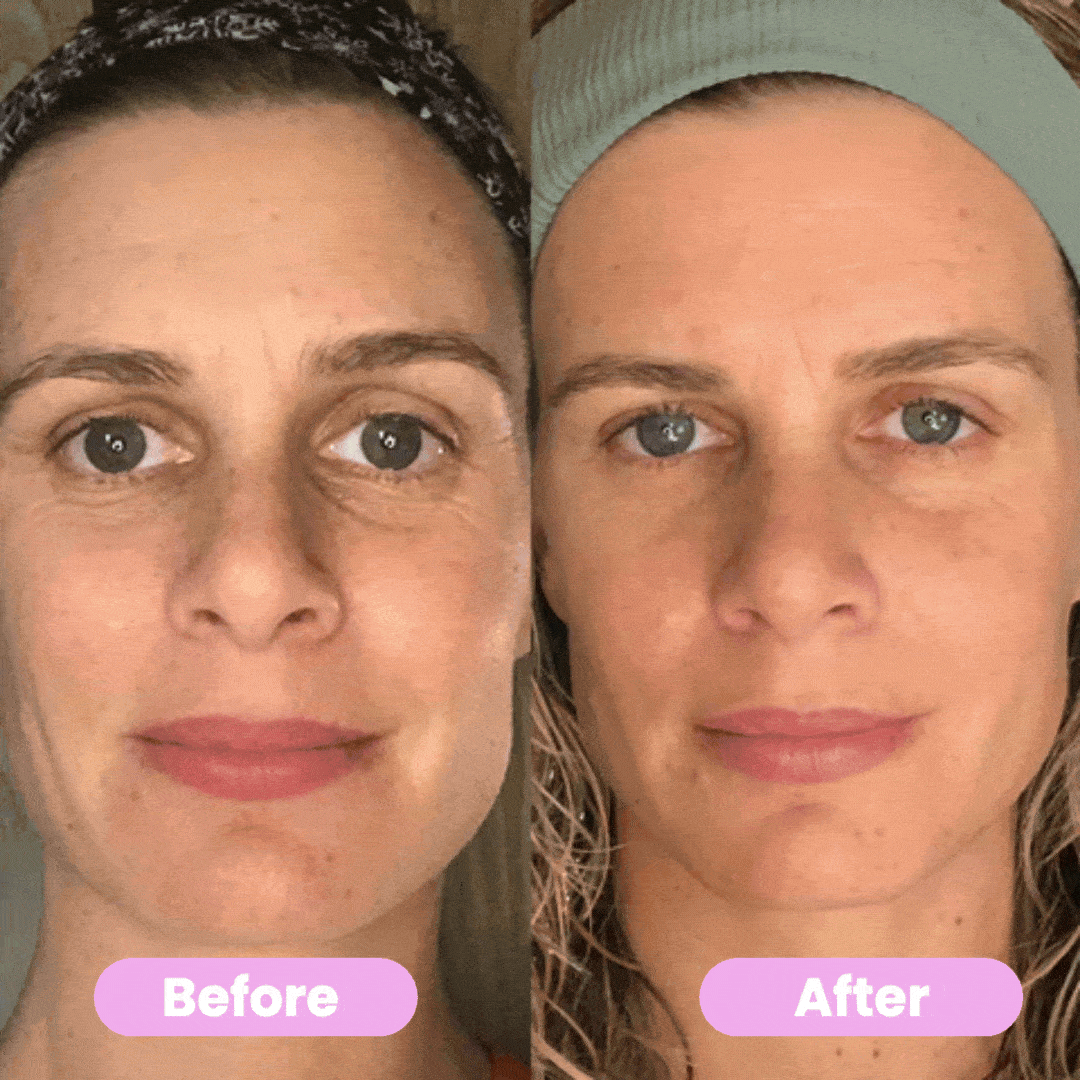Masseur Visage Anti-Âge – Lifting, Raffermissement et Revitalisation de la Peau